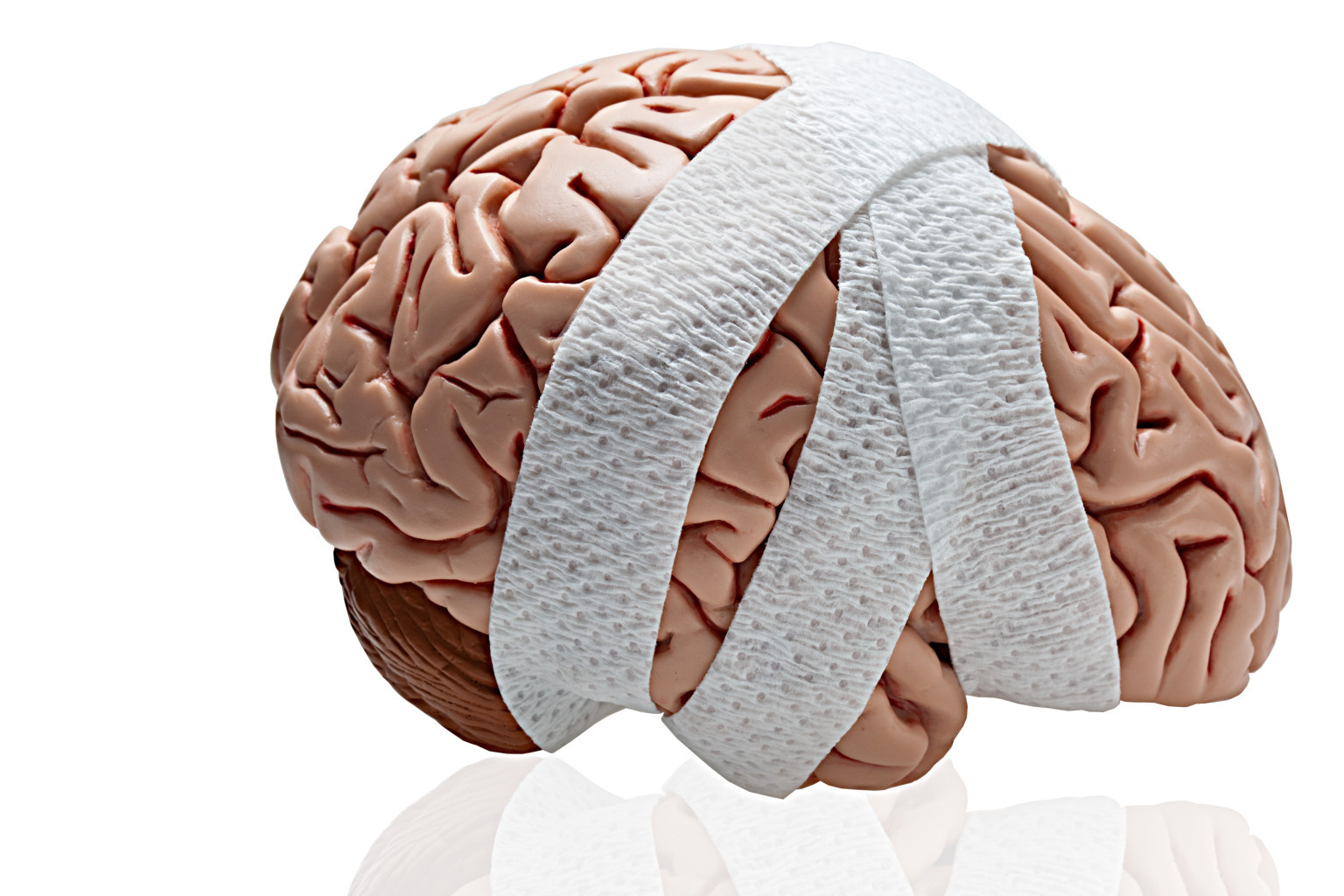 Anoxic Brain Injury Brainandspinalcord Org Brain Head Injury