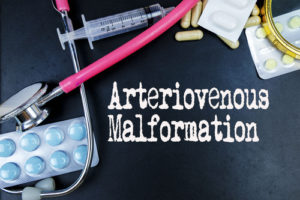 Can Arteriovenous Malformation Cause Acquired Brain Injury?