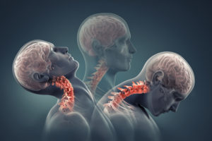 What Are The Symptoms Of A Neck Injury?